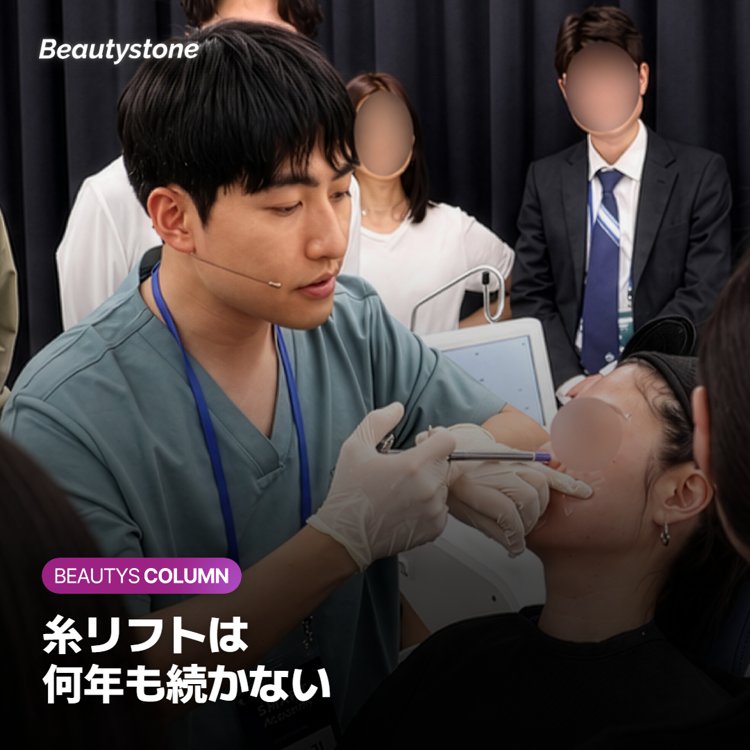糸リフトの効果はどのくらい続くのか