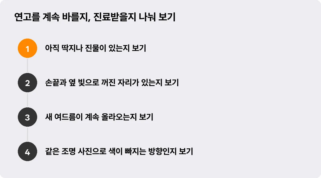 연고를 계속 바를지, 진료받을지 나눠 보기