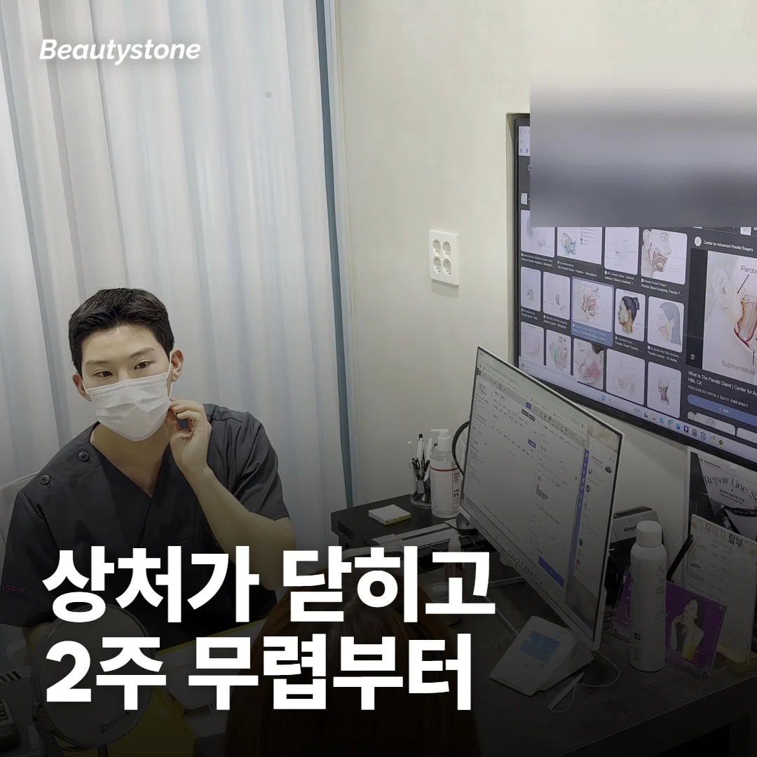 실밥 풀고 얼마나 지나야 받을 수 있나요?