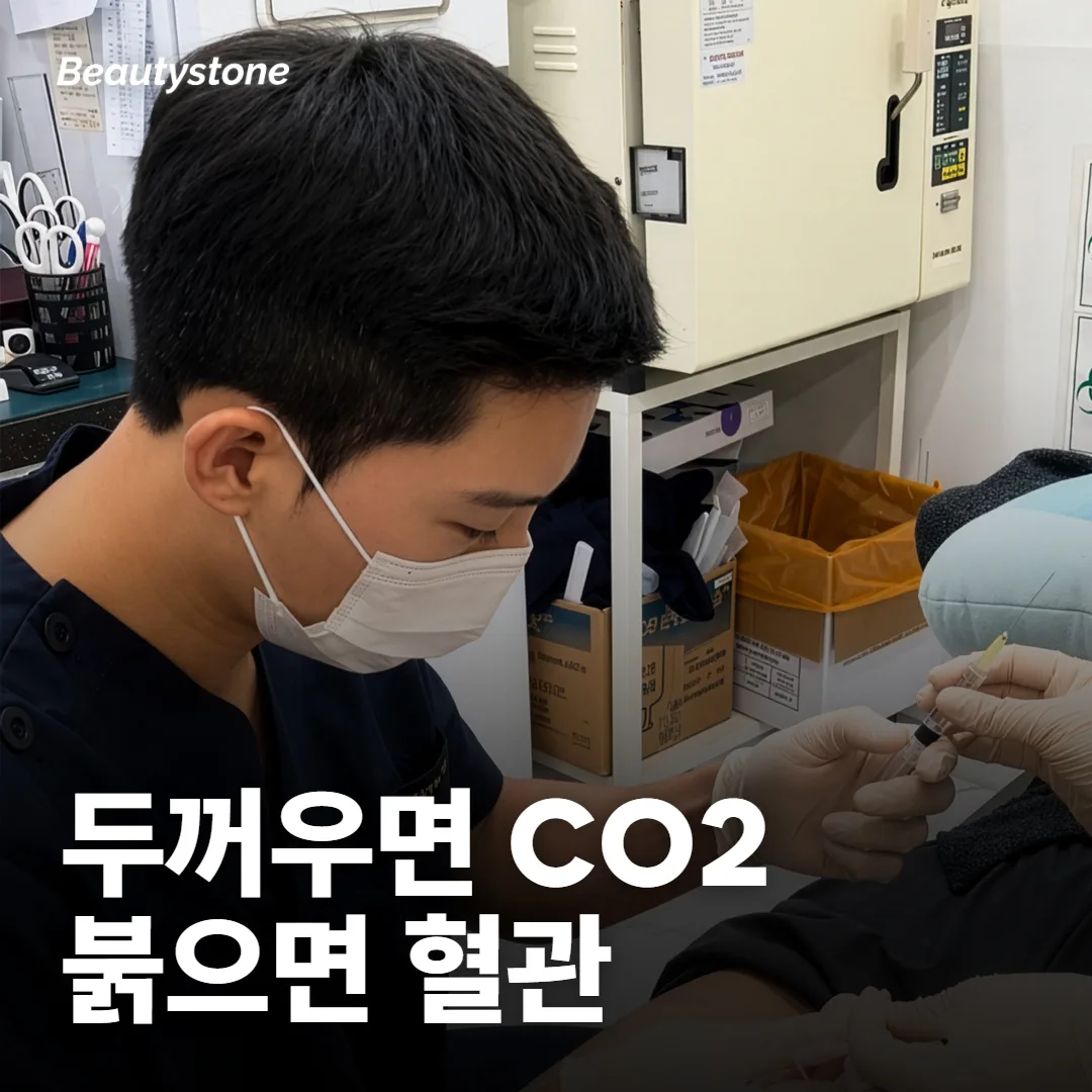 붉은 흉터와 두꺼운 흉터, CO2 프락셀이 맞는 쪽은 어디인가요?