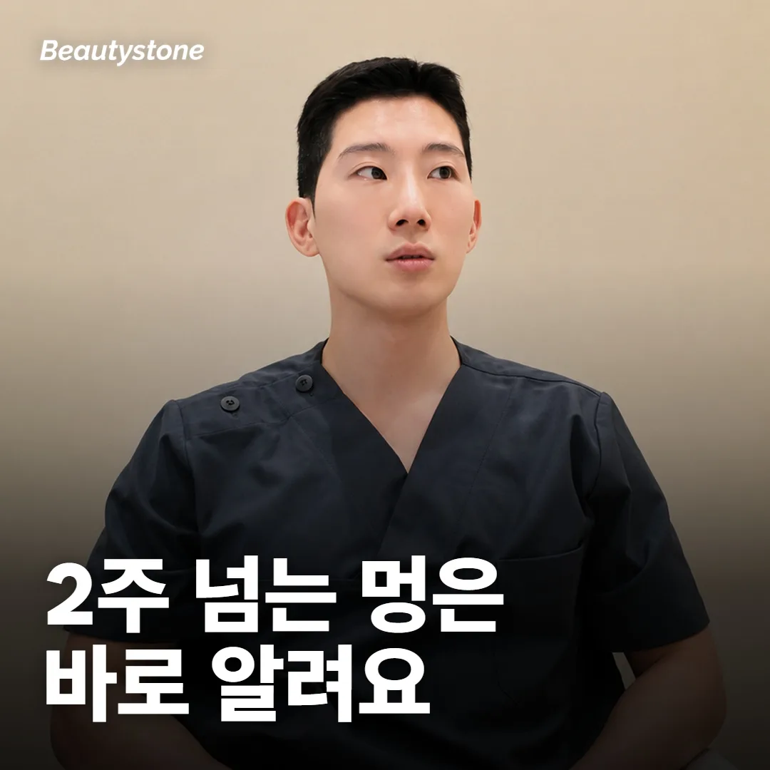 받은 뒤 어떤 반응은 지나가고, 무엇이면 연락해야 하나요?