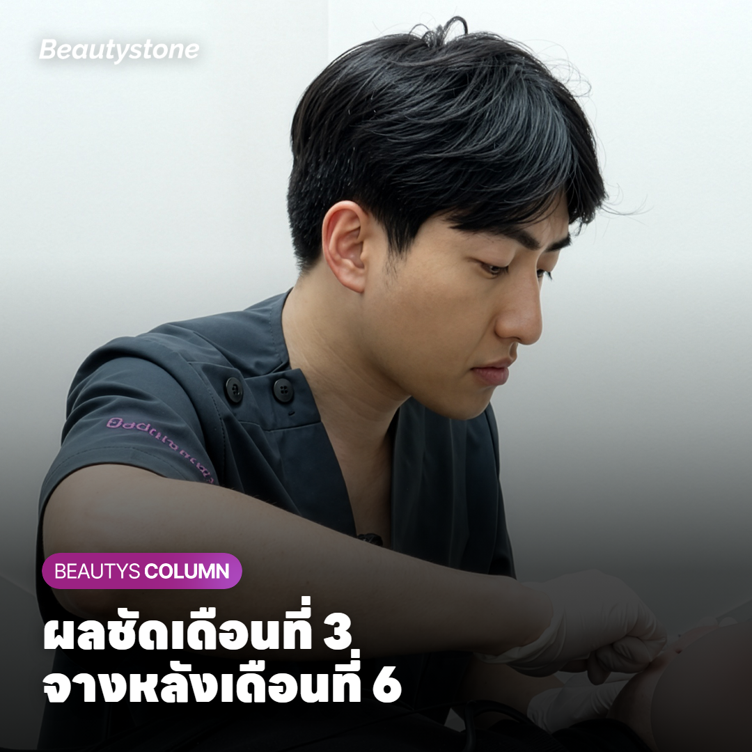 คุณหมอดูกรอบหน้าและแก้มเพื่อกำหนดระยะห่างของรอบ Shurink