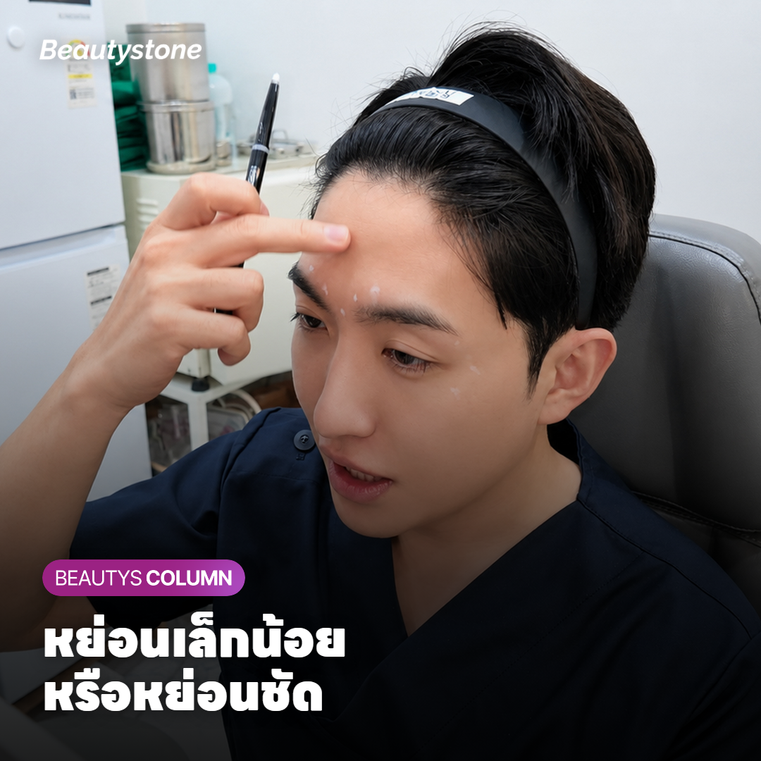 แพทย์ดูกรอบหน้าด้านข้างเพื่อเทียบอัลตราซาวด์ยกกระชับกับการร้อยไหม