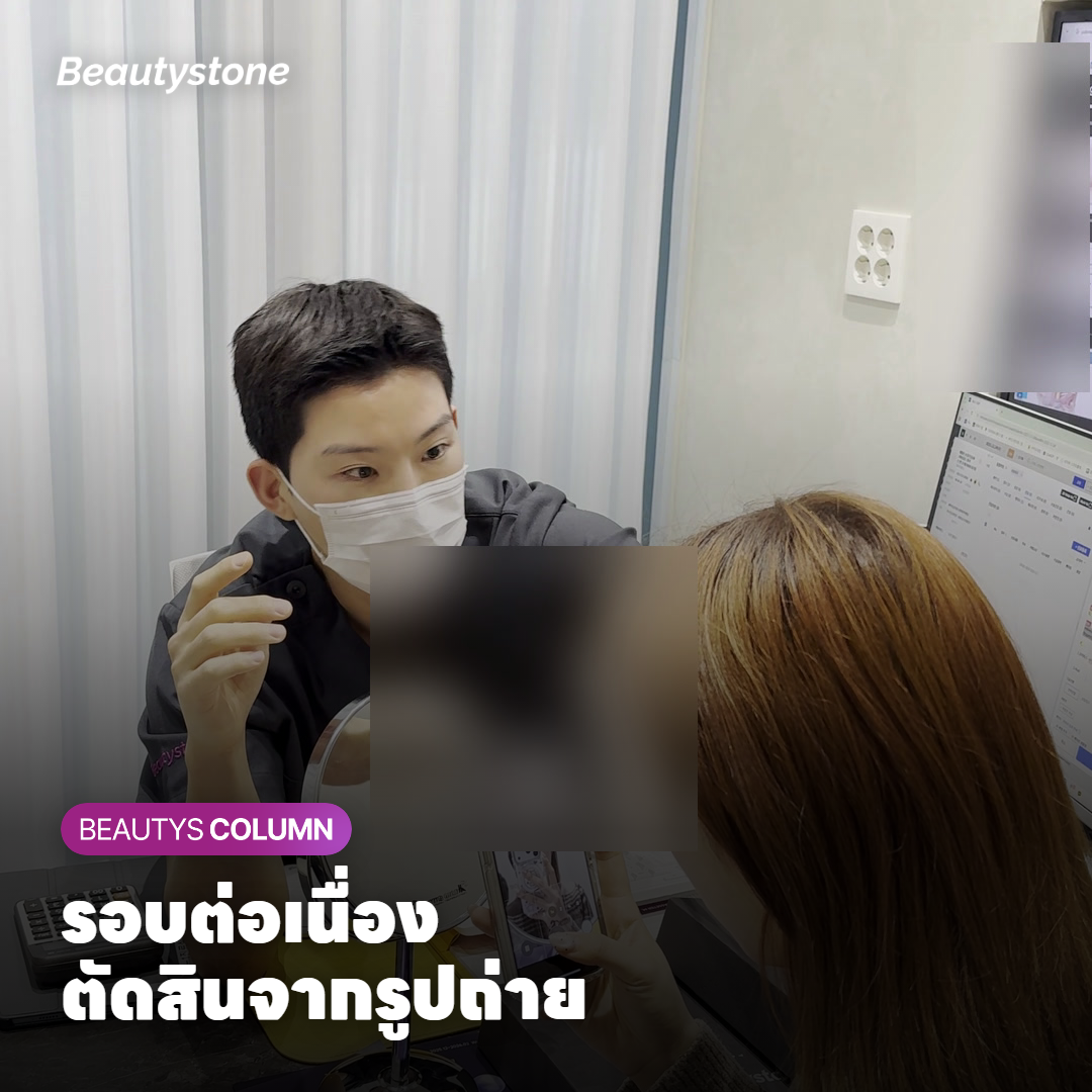 รูปถ่ายใบหน้าในแสงและมุมเดียวกันสำหรับเทียบผลหลังครั้งสุดท้าย