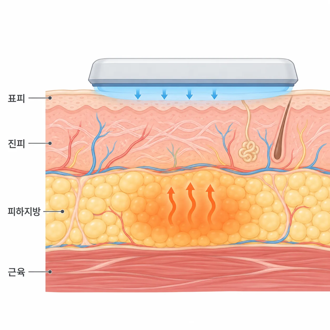 겉은 식히면서 열을 피하지방 층에 모아요