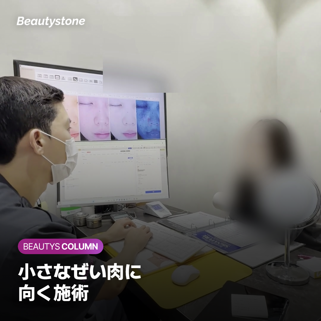 下腹の小さなぜい肉をつまんで厚みを確かめる様子