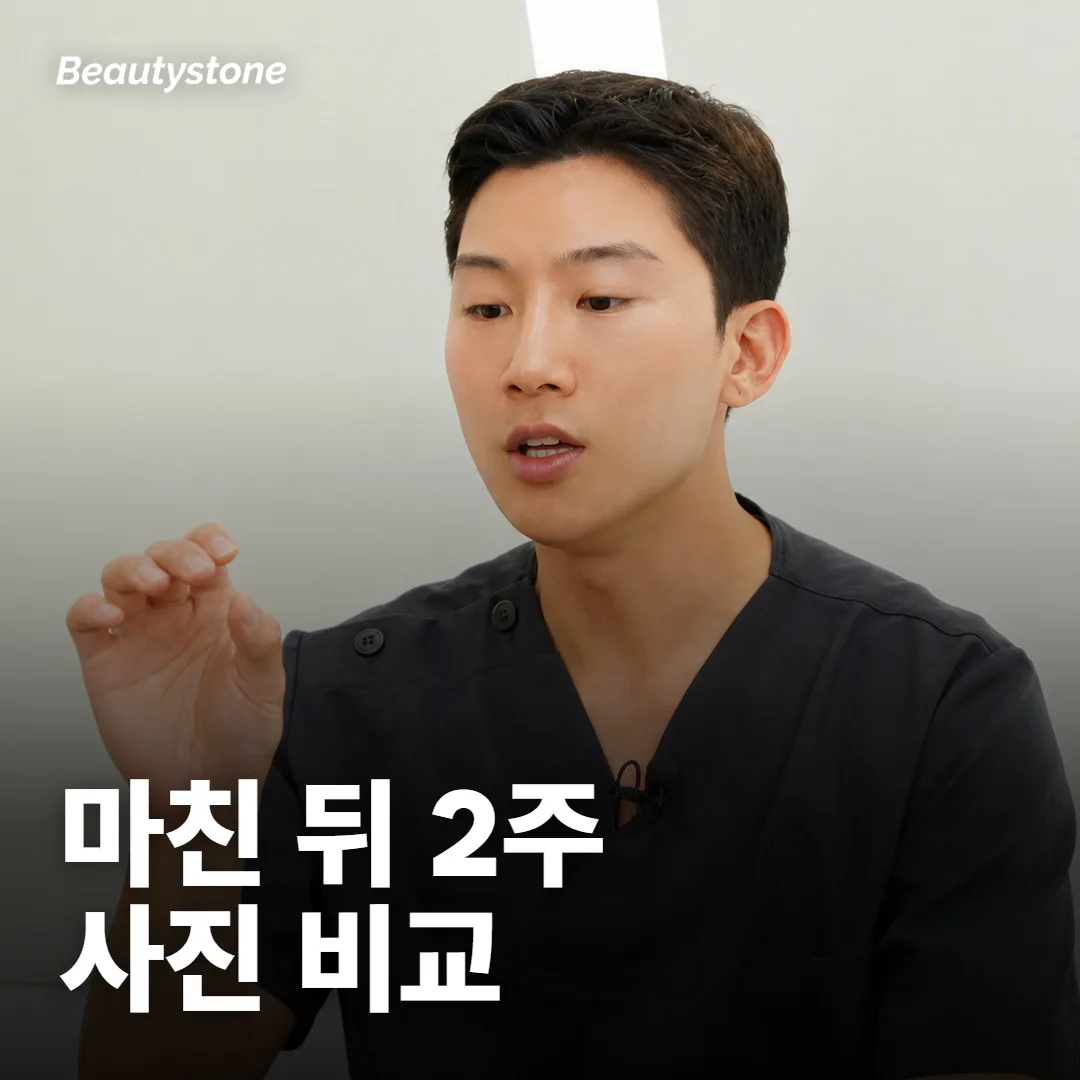 붉음이나 여드름이 고민이었다면 무엇을 비교해야 하나요?