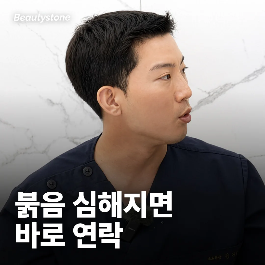받은 뒤 어떤 반응은 지나가고, 무엇이면 연락해야 하나요?