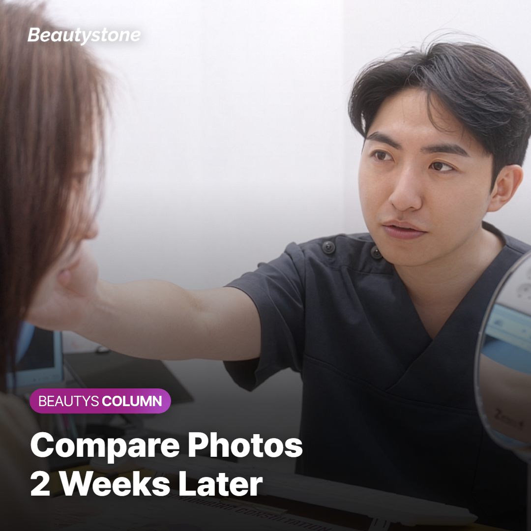 Cheek photos taken in the same lighting to compare redness over time