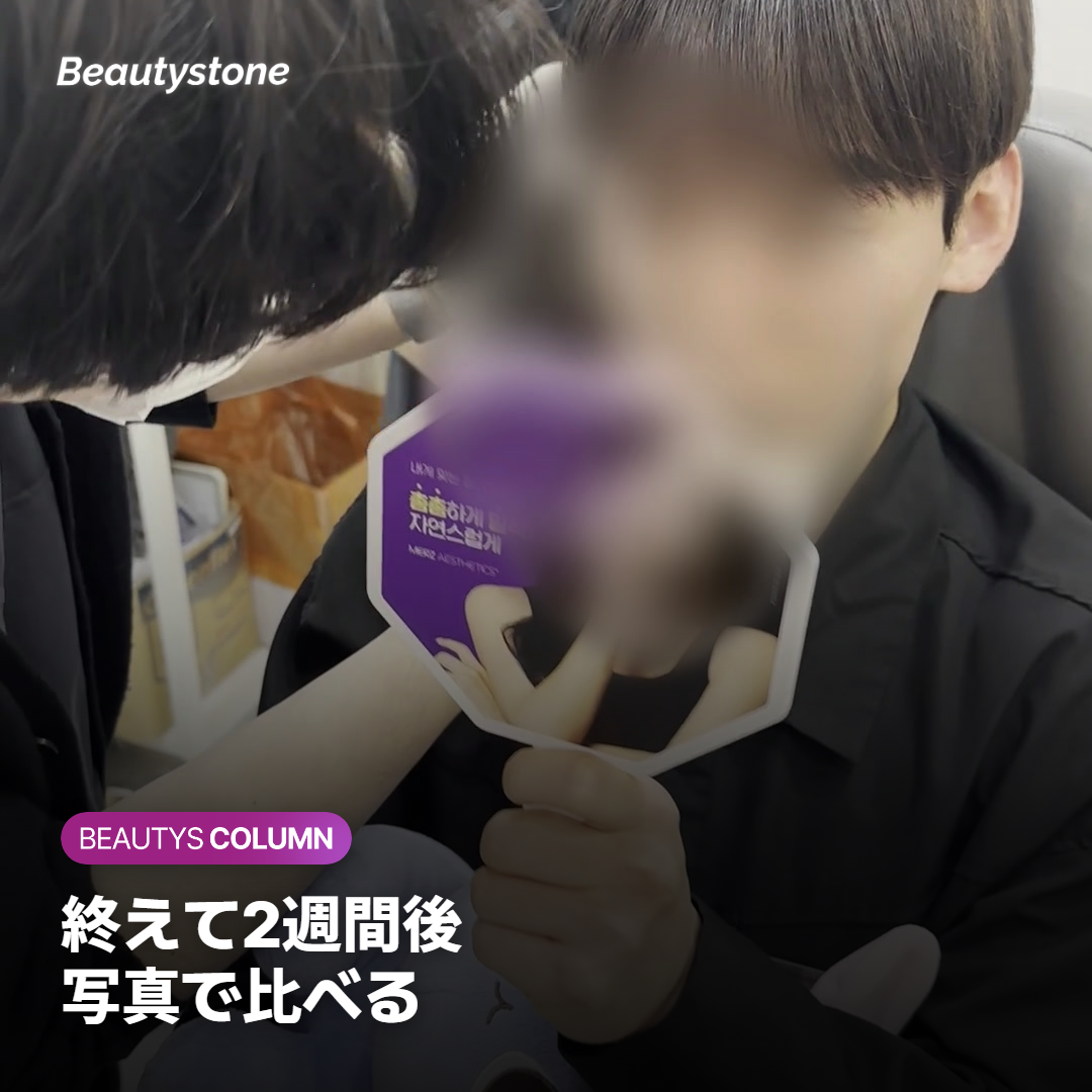 同じ照明で撮った頬の赤みの写真を並べて比べる様子