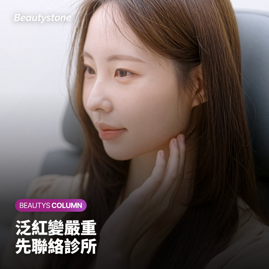 超音波療程後臉頰輕微泛紅的樣子