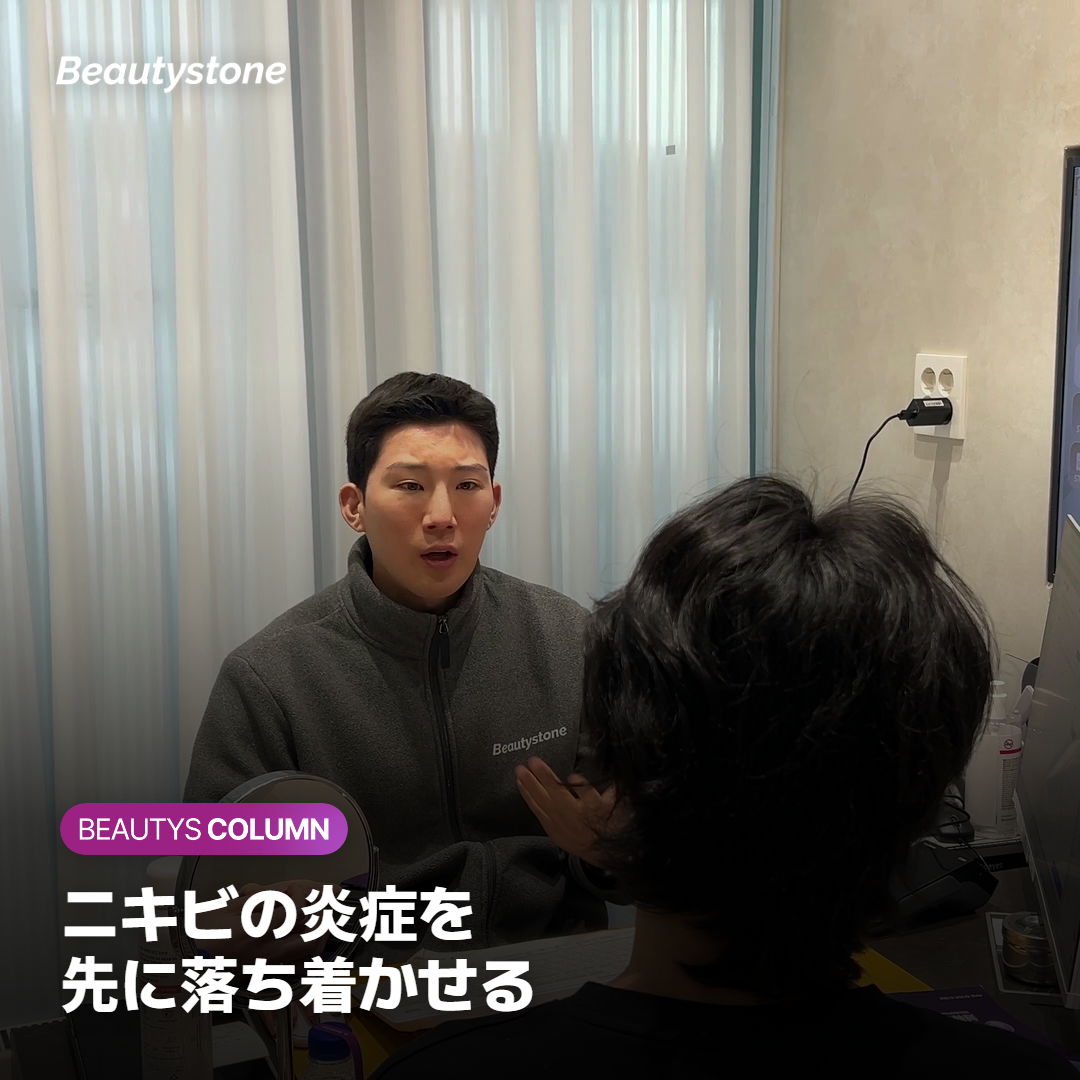赤く腫れたニキビがあるかを確かめる診察の様子