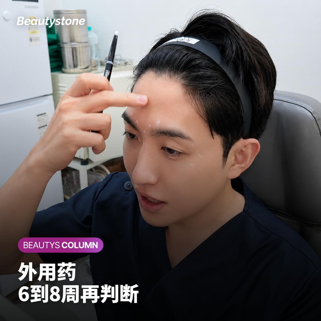 在家去黑头可用的外用药与洗面奶