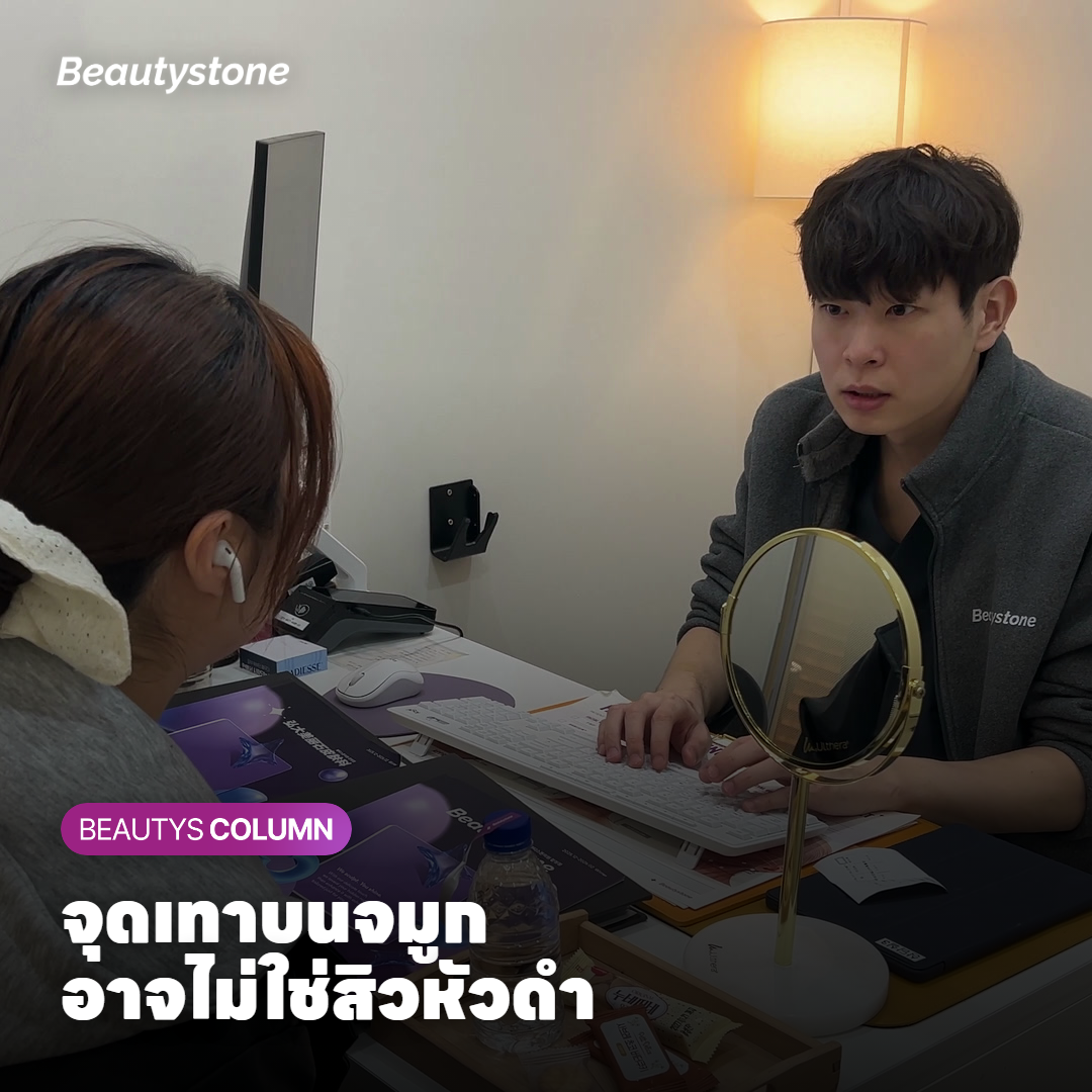 ภาพตัดขวางรูขุมขนที่เป็นสิวหัวดำเทียบกับ Sebaceous filament บนจมูก