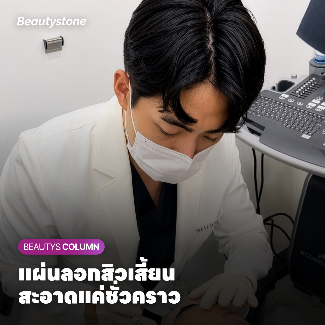 แผ่นลอกสิวเสี้ยนที่ลอกออกจากจมูก