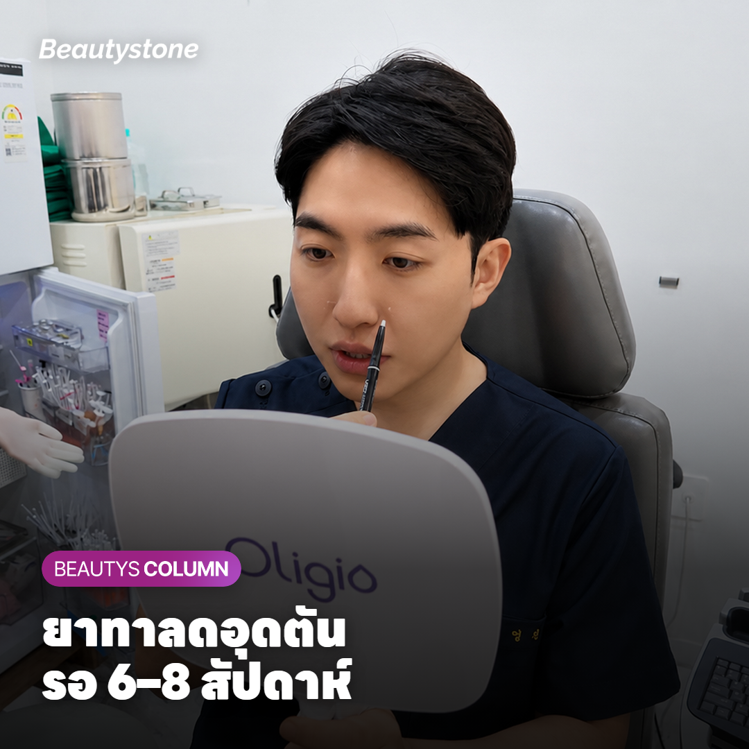 หลอดเจลอะดาพาลีนกับคลีนเซอร์บนอ่างล้างหน้า