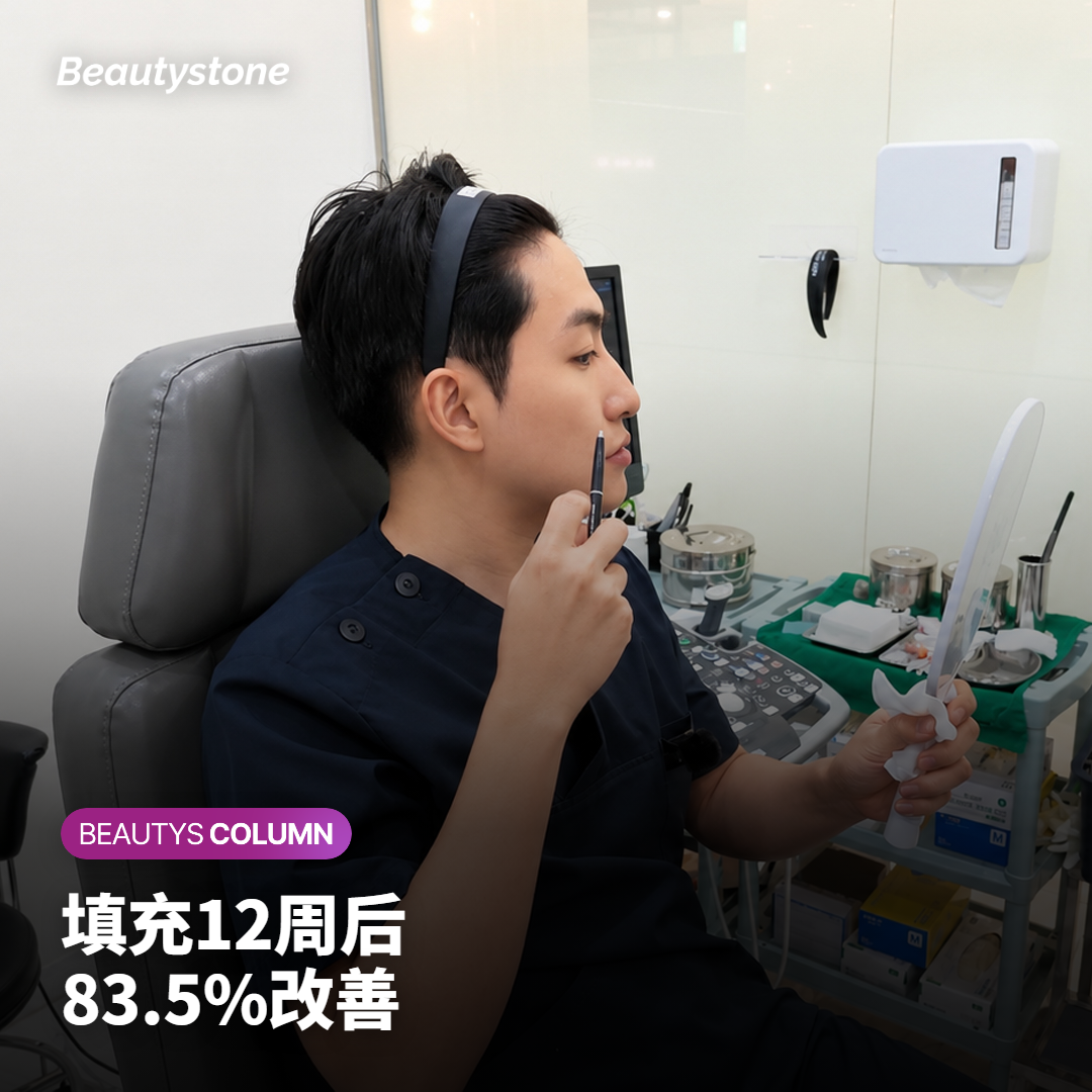 嘴角下方凹陷的木偶纹用填充撑起