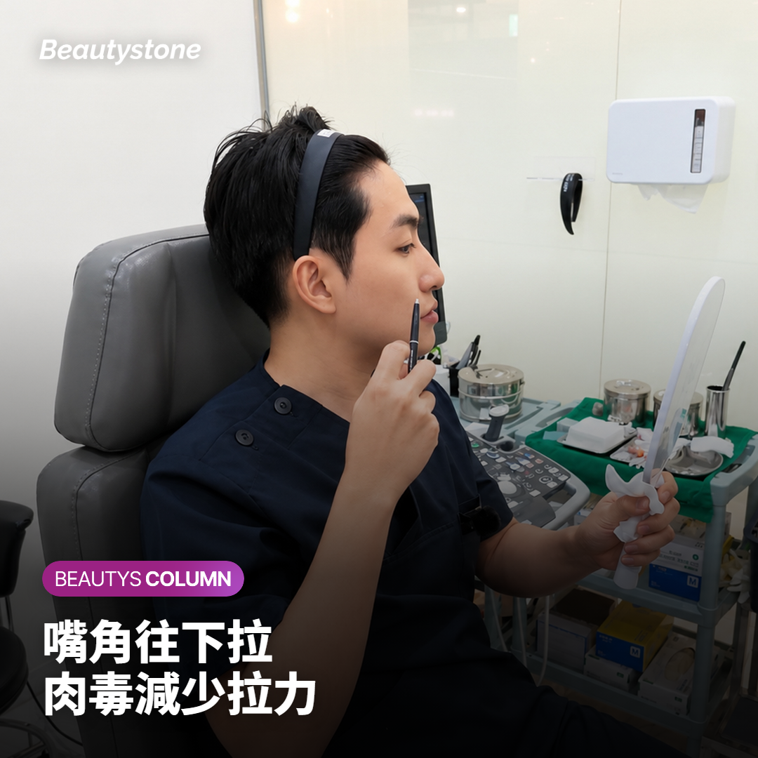 從嘴角往下巴延伸的降口角肌與肉毒桿菌素注射位置的示意圖