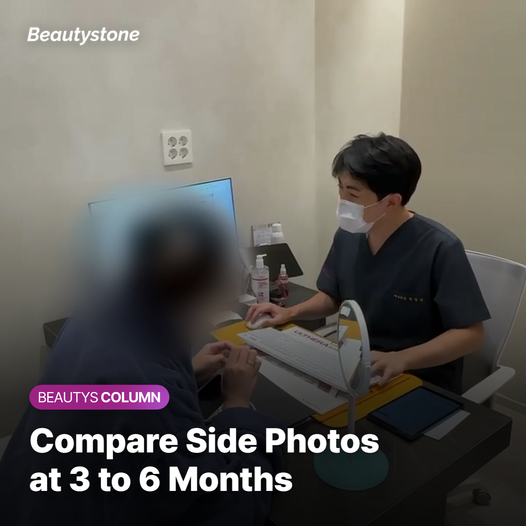 Two side-view photos of the same face taken under the same light months apart