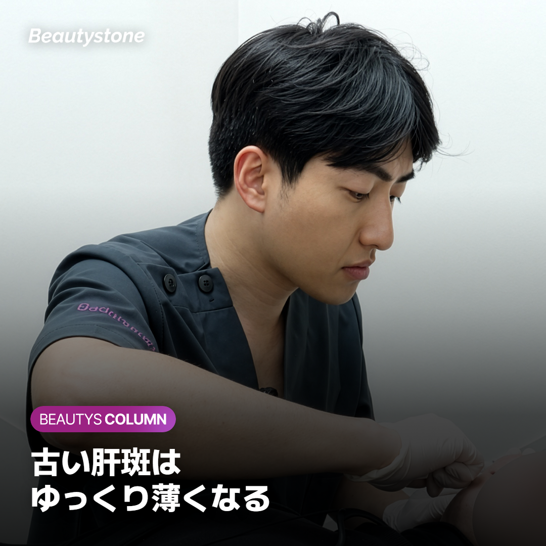 肝斑のレーザーは何回？回数が変わる理由
