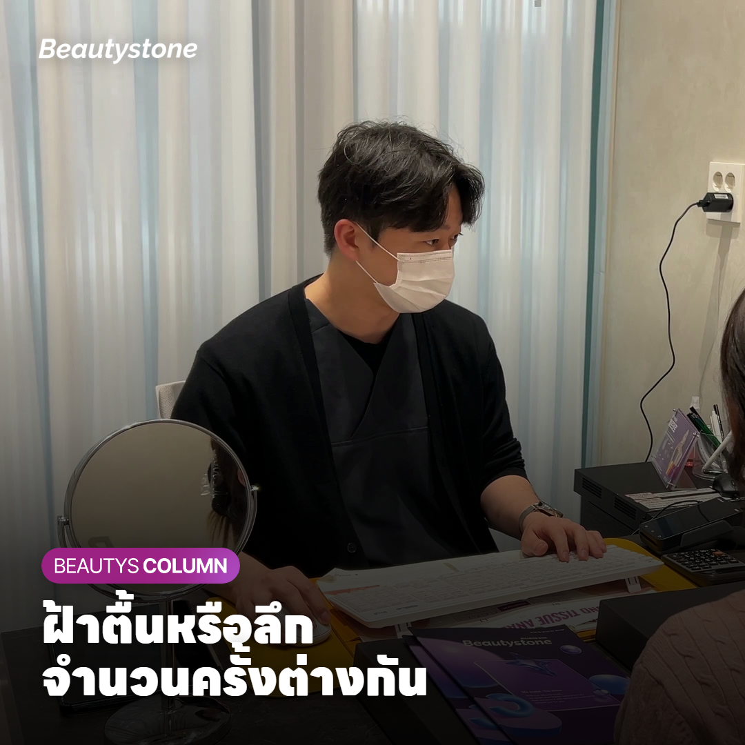 ภาพตัดขวางผิวแสดงเม็ดสีฝ้าในชั้นหนังกำพร้าและชั้นหนังแท้