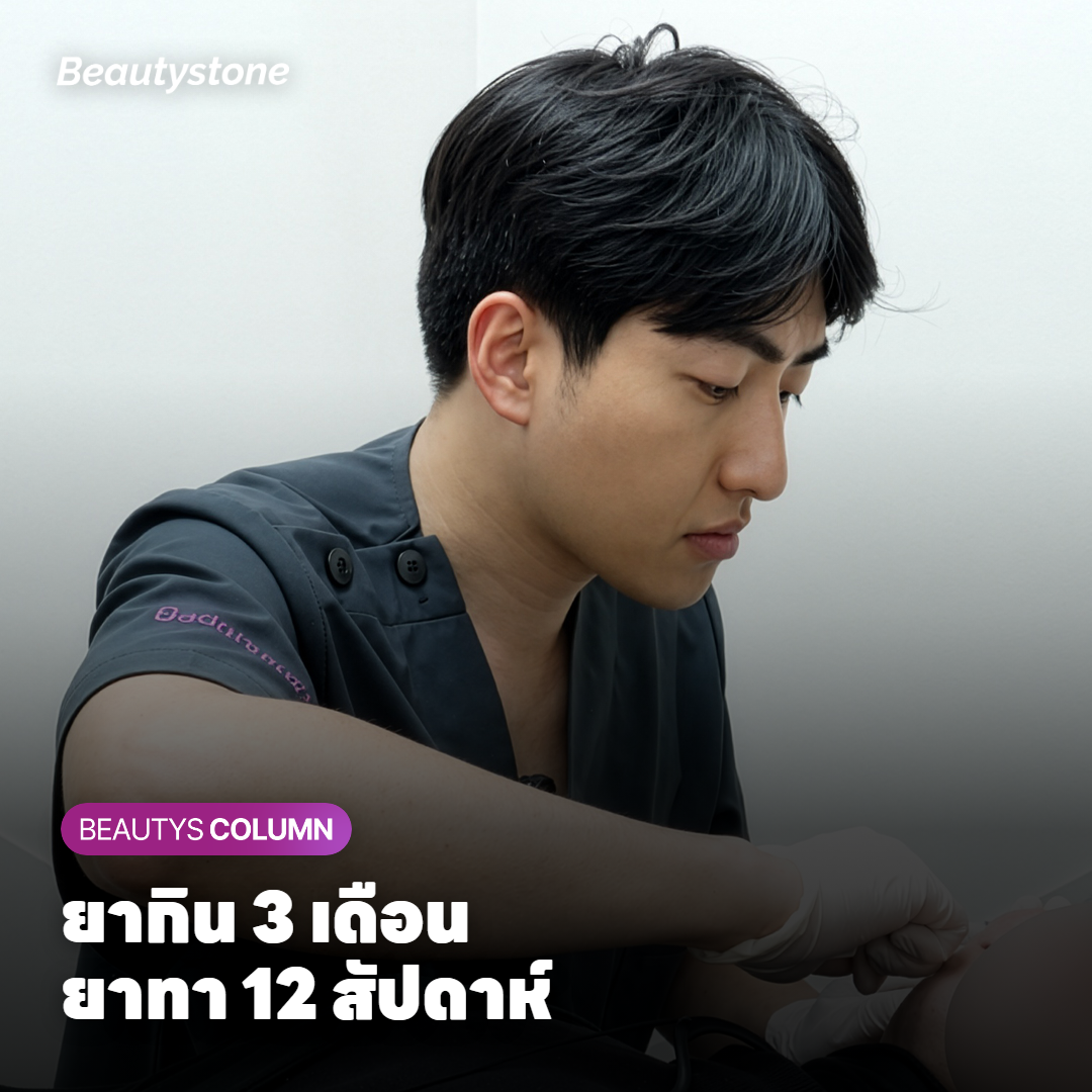 ยาเม็ดกับหลอดยาทารักษาฝ้าวางคู่กัน