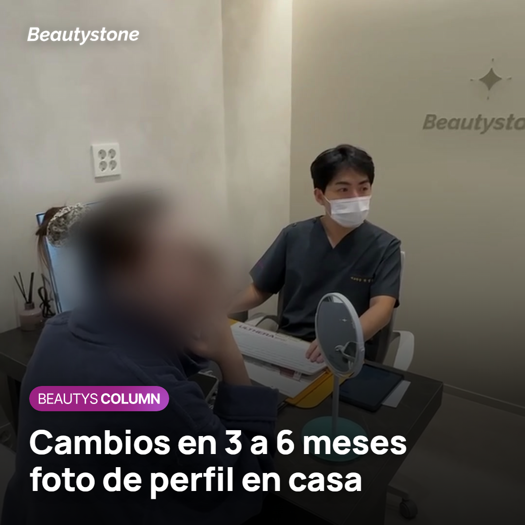 Dos fotos de perfil tomadas con meses de diferencia