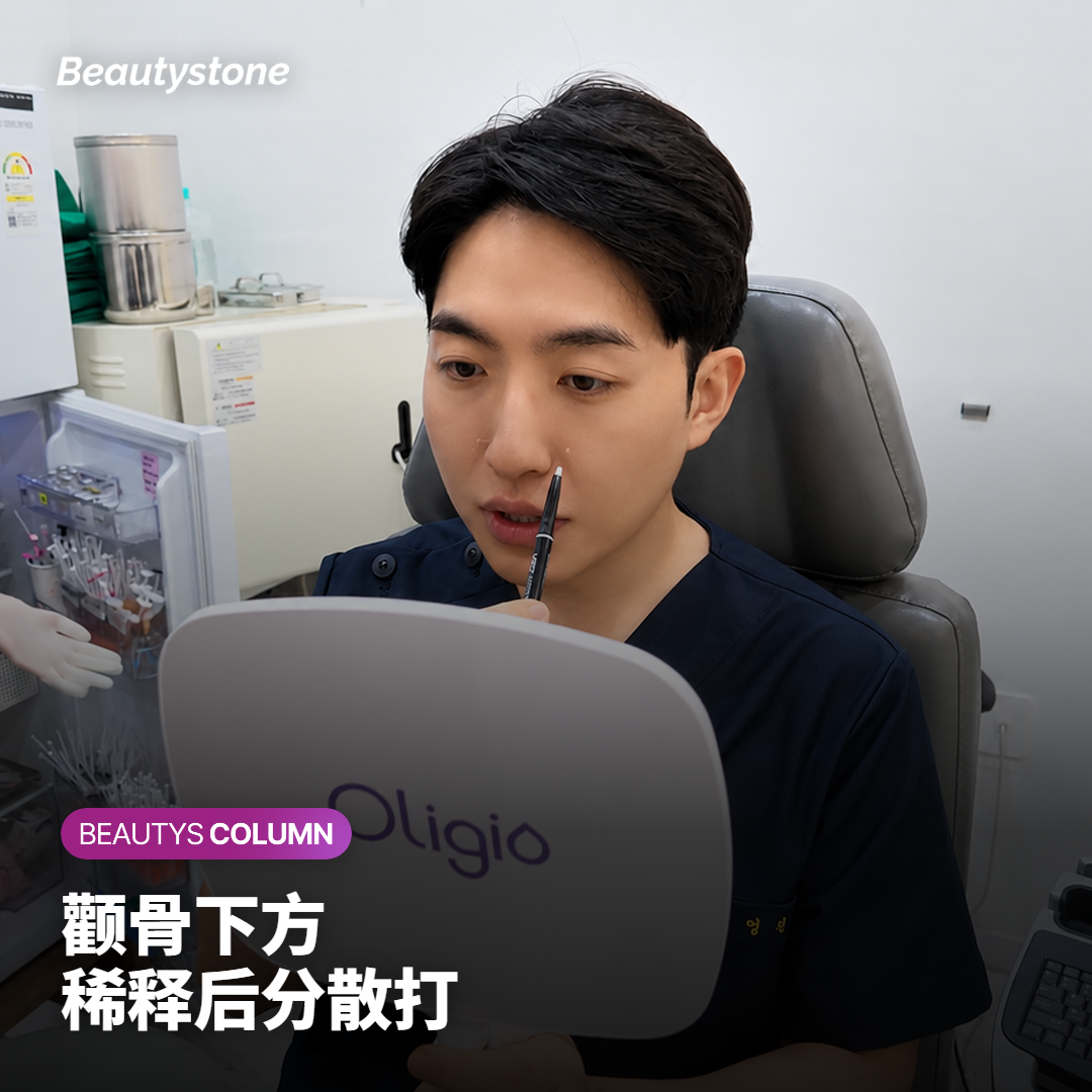 产品分散在脸颊浅层脂肪的剖面图