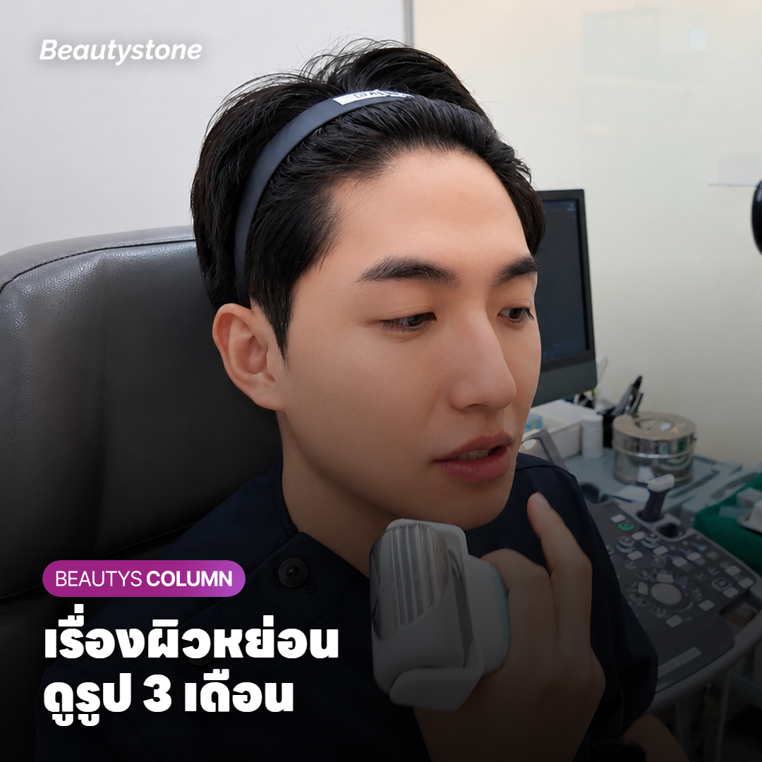 รูปด้านข้างของกรอบหน้าและใต้คางสำหรับเทียบผลที่ 3 เดือน