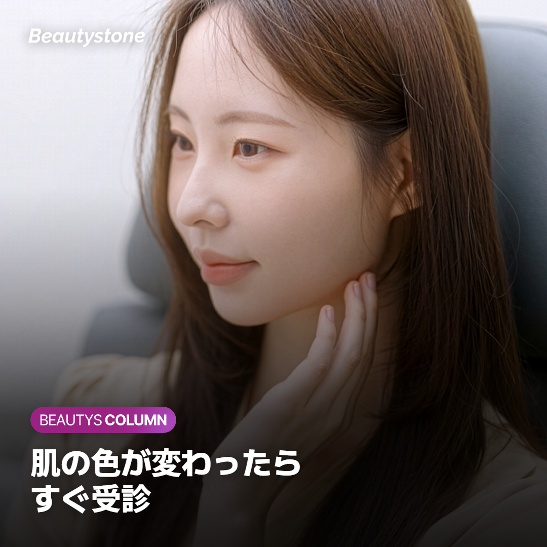 唇フィラー直後の軽い腫れを鏡で確認している様子