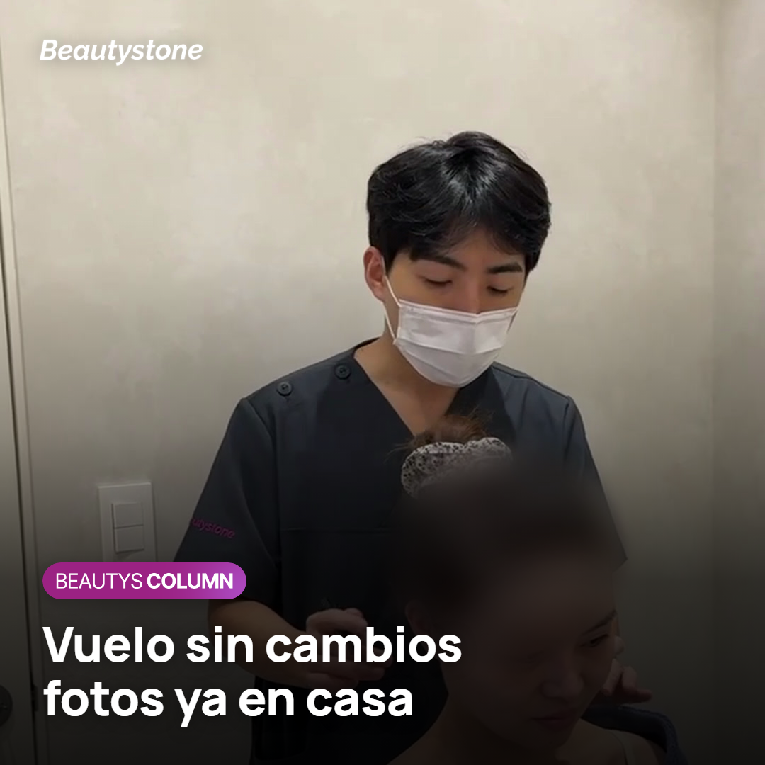 Persona revisando fotos de su rostro en casa tras el viaje