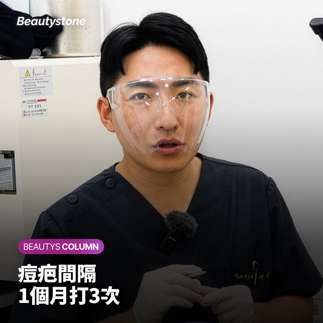 臉頰上滾動型和冰錐型痘疤的特寫