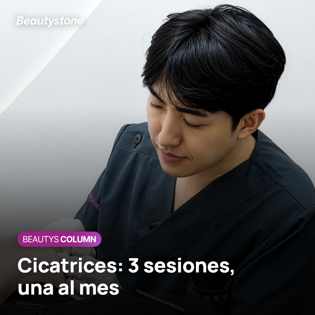 Mejilla con cicatrices de acné onduladas y otras estrechas y profundas