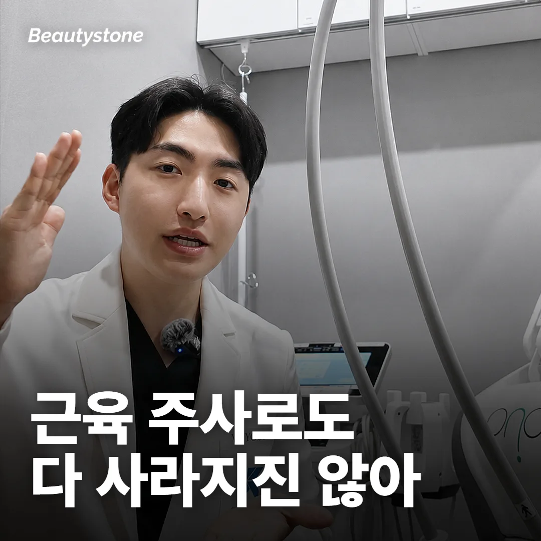 표정을 풀어도 남는 미간 주름, 보툴리눔 주사로 얼마나 옅어지나요?