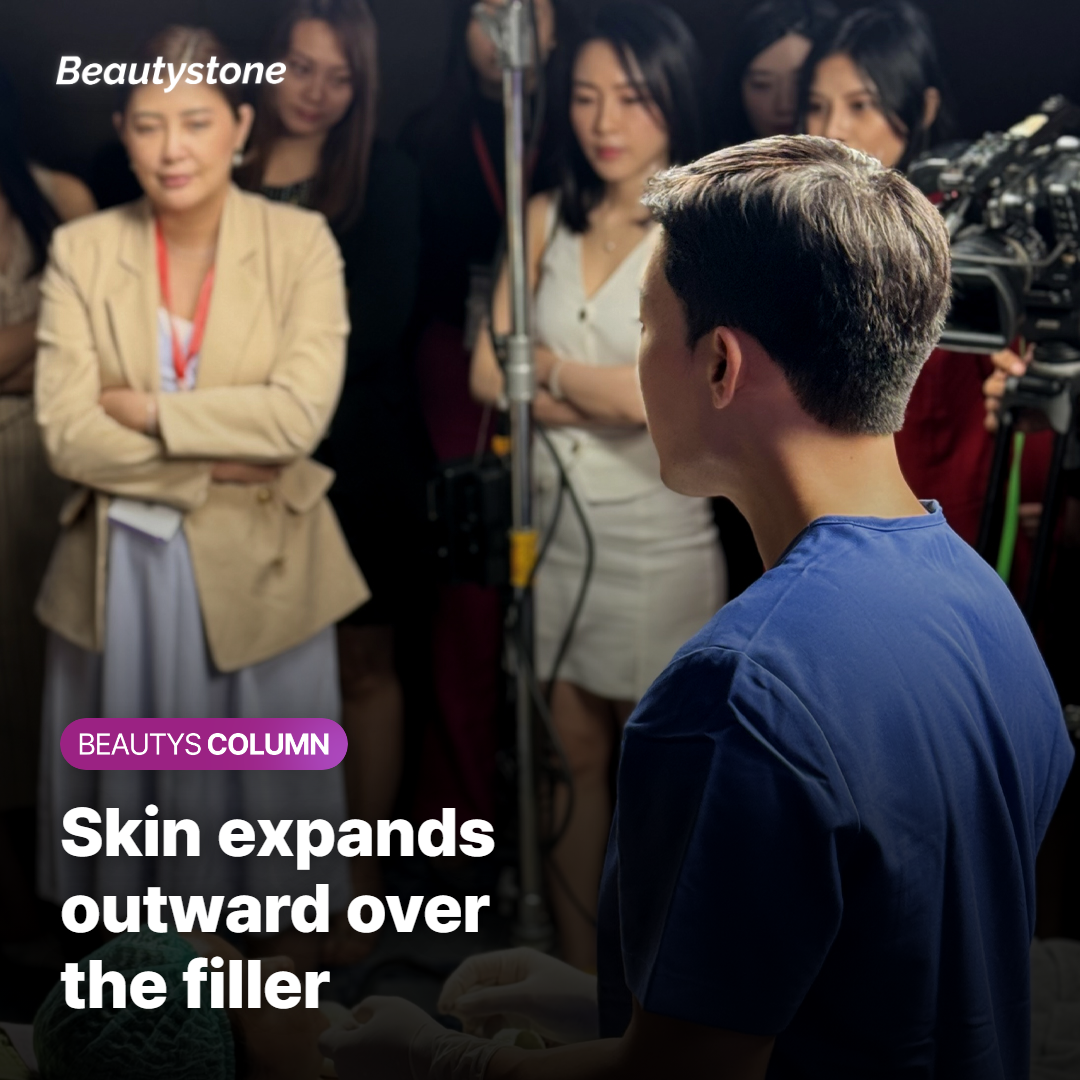 Skin expanding outward over cheek filler