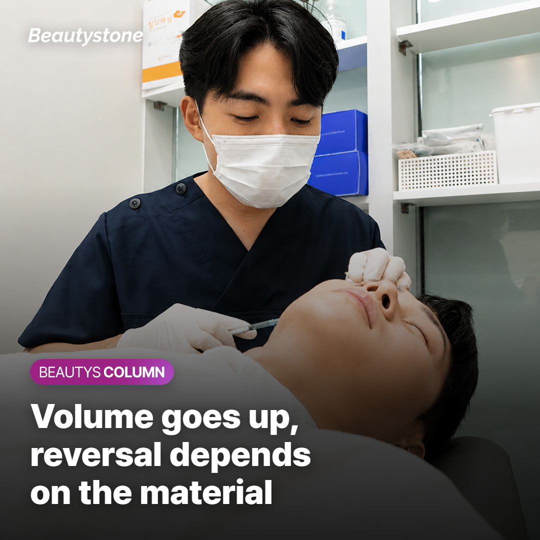 Cheek volume added by filler and how reversible each material is