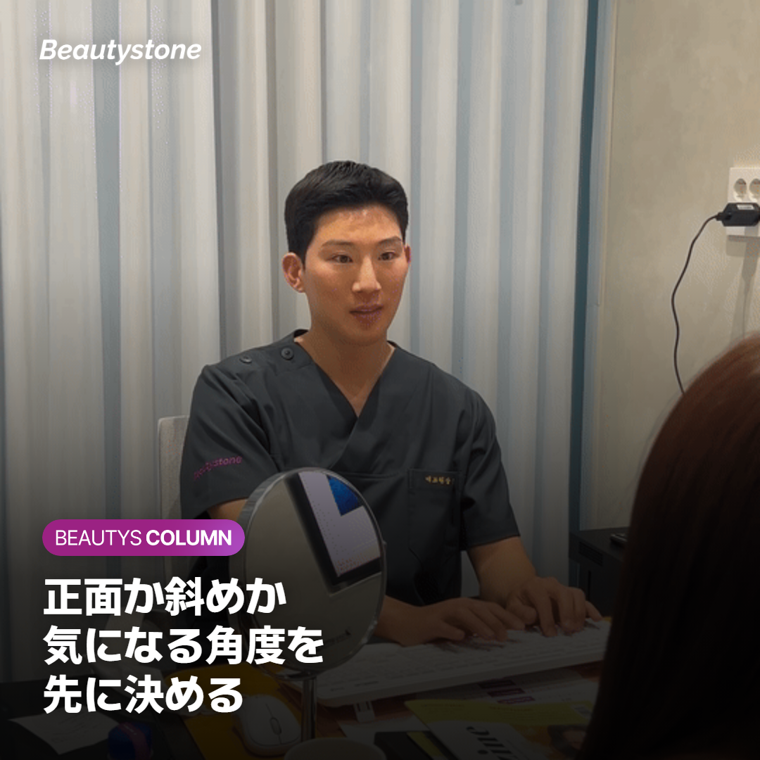 正面と斜めの写真で見る頬の前側と横側のくぼみ