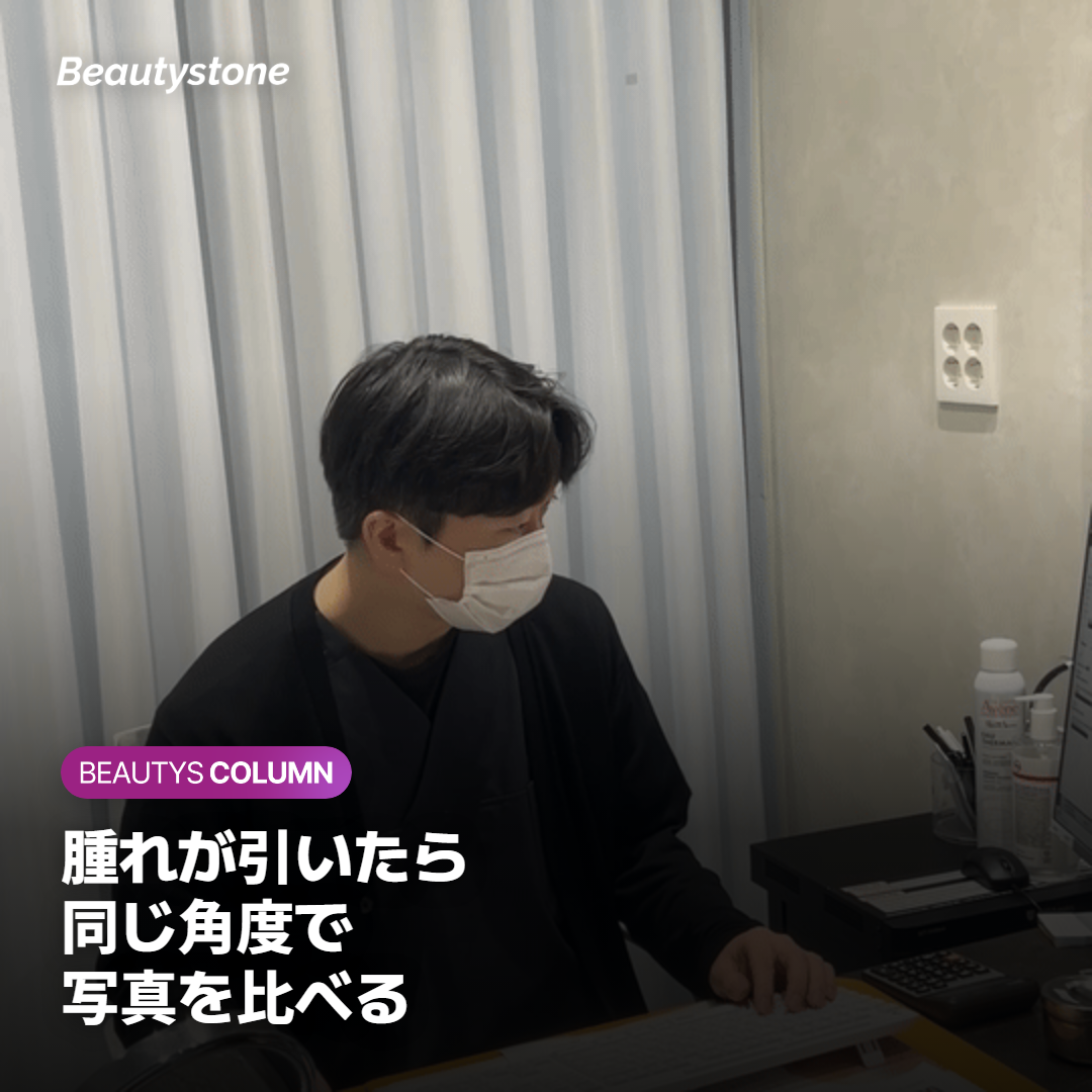 頬のフィラー後のふつうの腫れと、すぐ受診するサイン