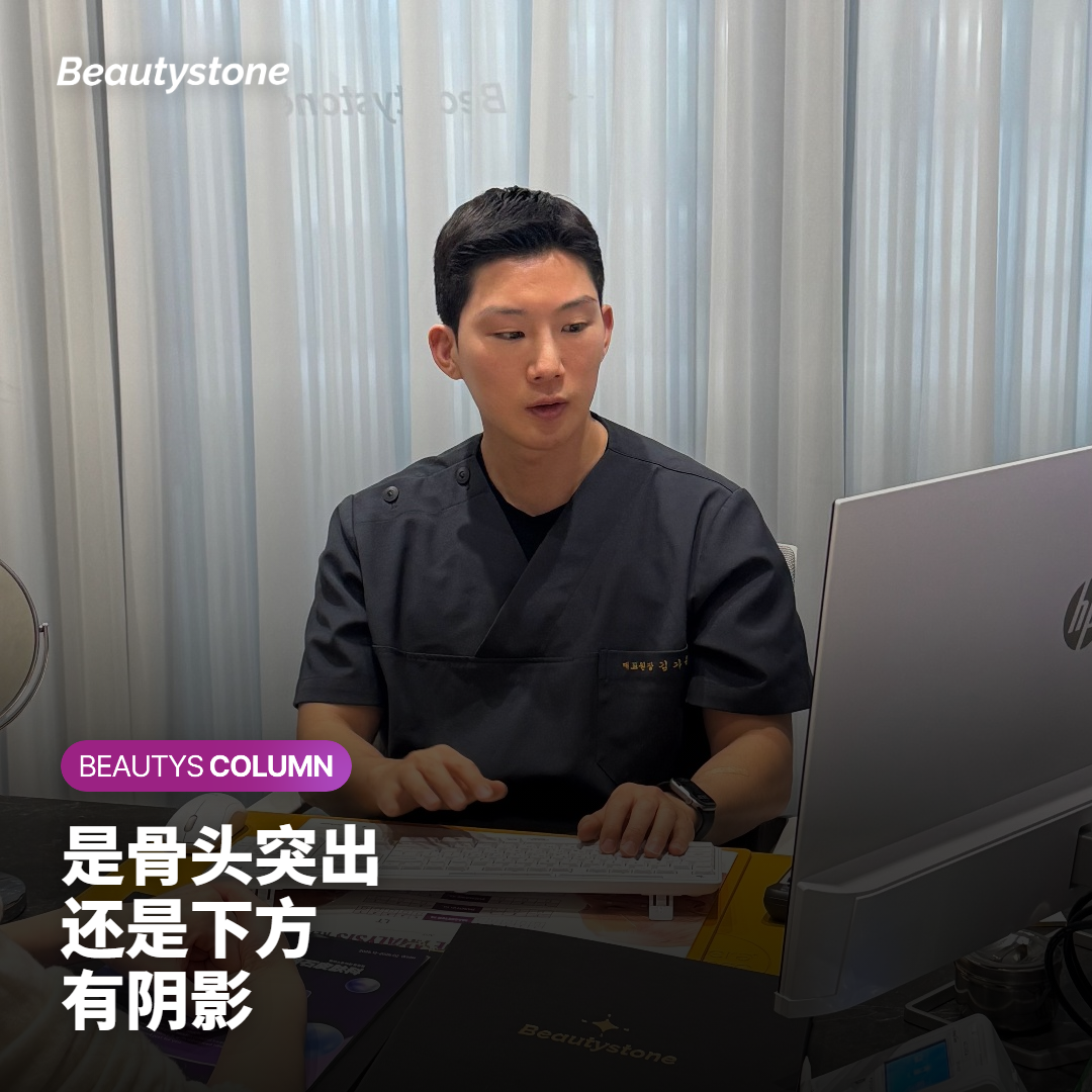 颧骨下方阴影与颧骨本身突出的区别