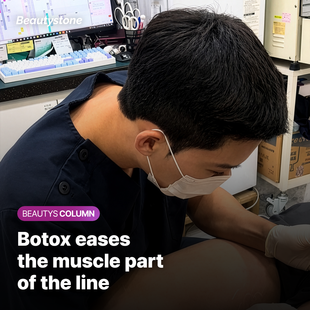 How botulinum toxin eases the muscle part of a glabella line