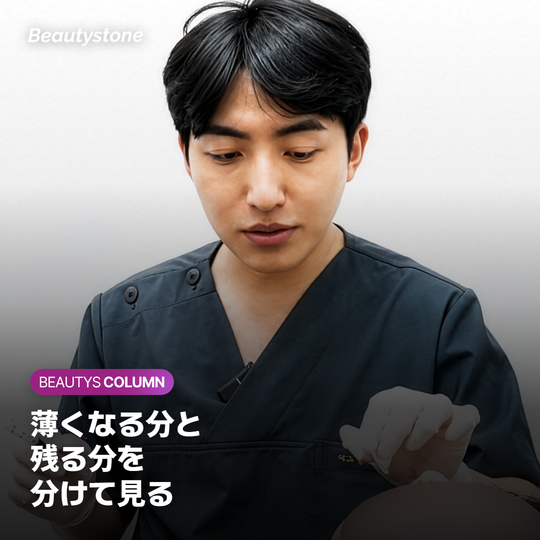 ボトックスをくり返したときの真顔の眉間のシワの変化