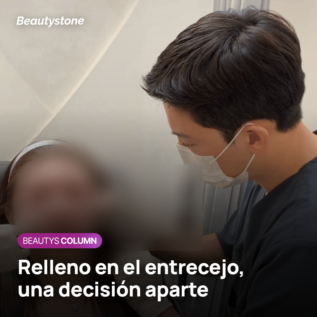 Surco del entrecejo y la decisión de usar relleno
