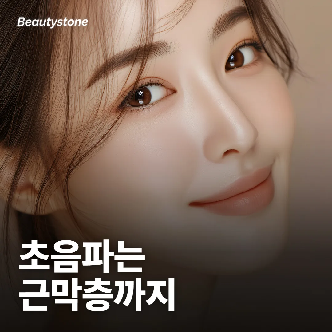 슈링크는 처진 얼굴선에 어떻게 작용하나요?