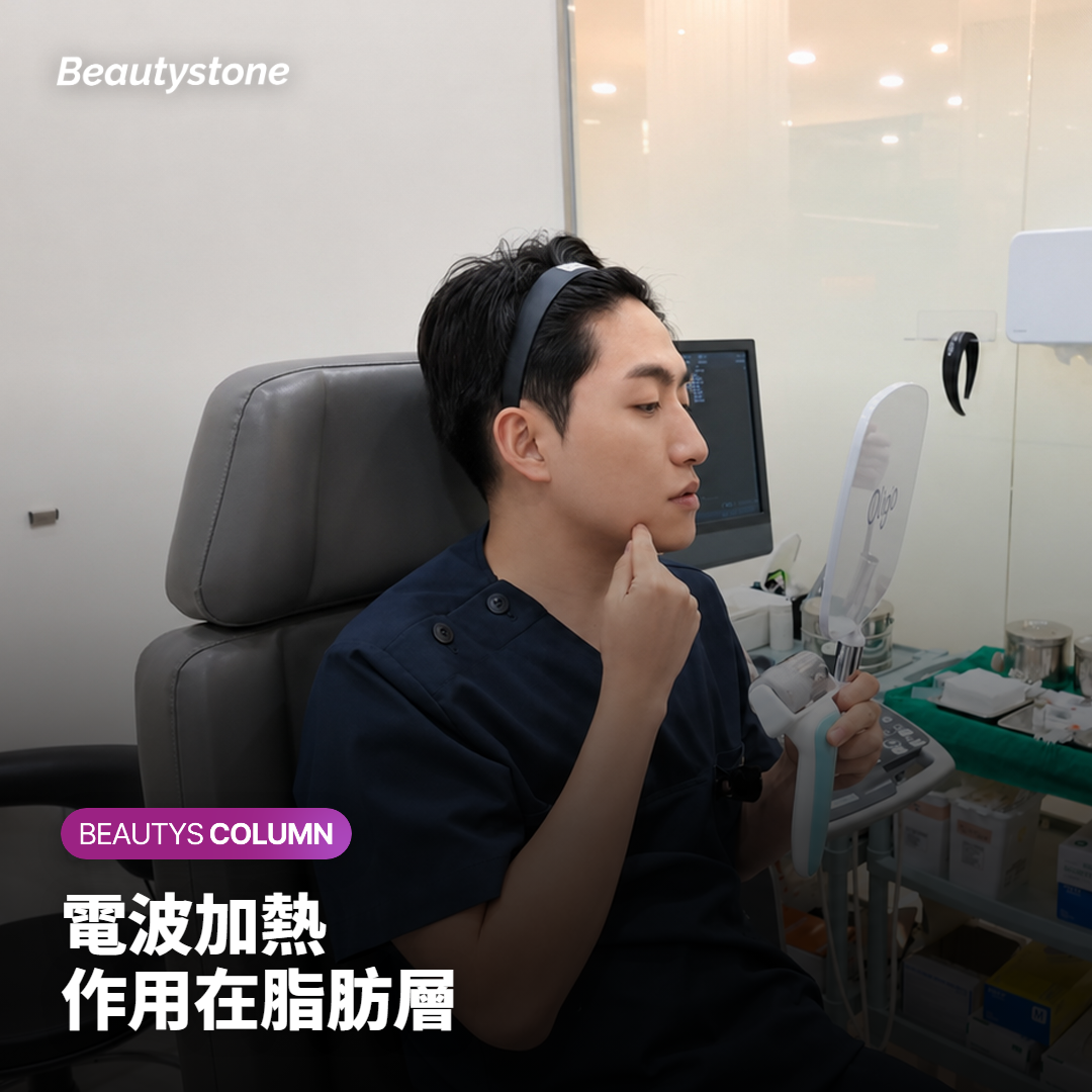 電波熱度作用在下巴下方脂肪層的示意圖
