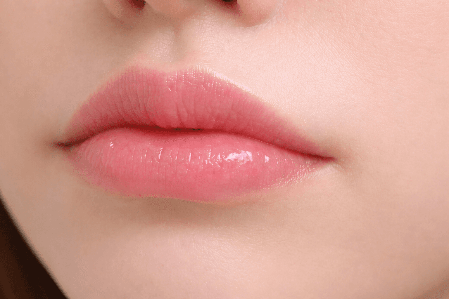 唇部填充剂1cc心得，搭配嘴角肉毒杆菌的理由