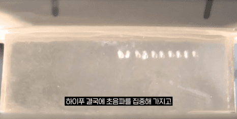 울쎄라 써마지 효과와 차이점 완벽 비교